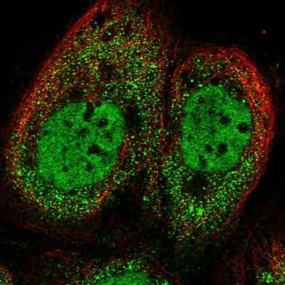 Immunocytochemistry/ Immunofluorescence: ZUFSP Antibody [NBP1-92646]