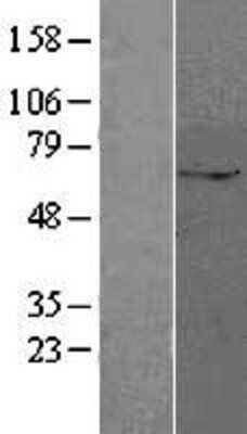 Western Blot: ZUFSP Overexpression Lysate [NBL1-18276]