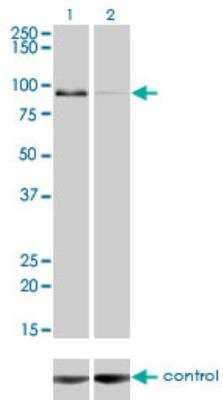 Western Blot: ZW10 Antibody (2E5) [H00009183-M05]