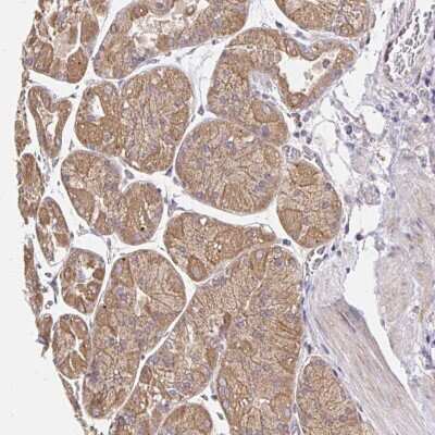 Immunohistochemistry-Paraffin: ZW10 Antibody [NBP2-38644]