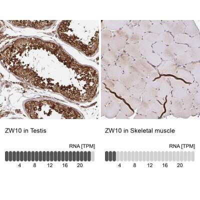 Immunohistochemistry-Paraffin: ZW10 Antibody [NBP2-38751]