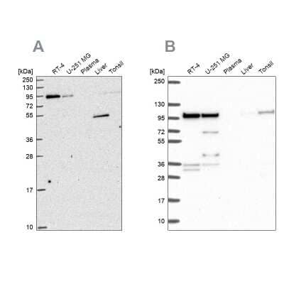 Western Blot: ZW10 Antibody [NBP2-38644]