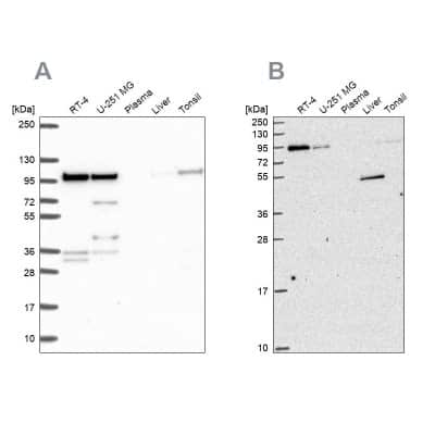 Western Blot: ZW10 Antibody [NBP2-38751]