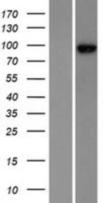 Western Blot: ZW10 Overexpression Lysate [NBP2-07836]