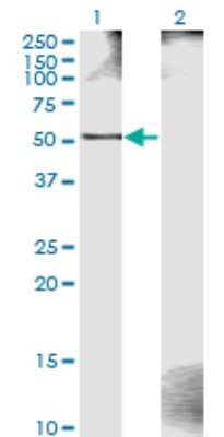 Western Blot: ZWILCH Antibody (1C10) [H00055055-M11]