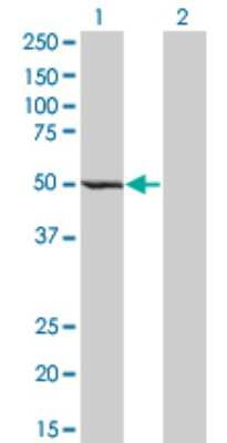 Western Blot: ZWILCH Antibody (1C9) [H00055055-M01]