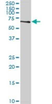 Western Blot: ZWILCH Antibody [H00055055-D01P]