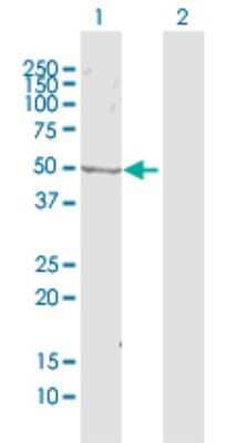 Western Blot: ZWILCH Antibody [H00055055-D01P]