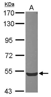 Western Blot: ZWILCH Antibody [NBP2-21057]