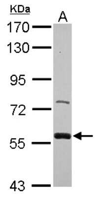 Western Blot: ZWILCH Antibody [NBP2-21058]