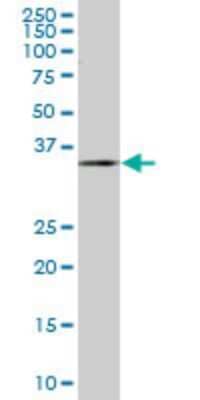 Western Blot: ZWINT Antibody (1B7) [H00011130-M04]