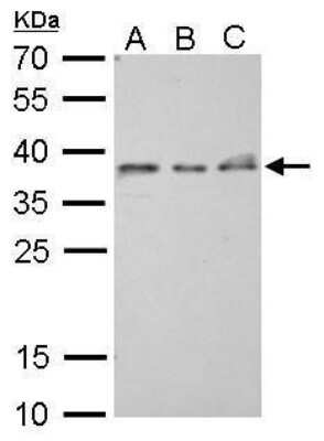 Western Blot: ZWINT Antibody (276) [NBP2-43562]