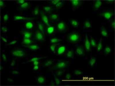 Immunocytochemistry/ Immunofluorescence: ZWINT Antibody (6D3) [H00011130-M01]