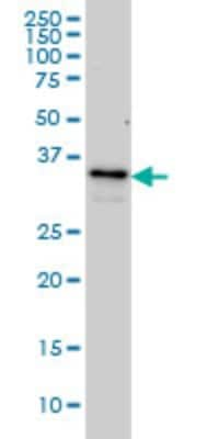 Western Blot: ZWINT Antibody (6D3) [H00011130-M01]