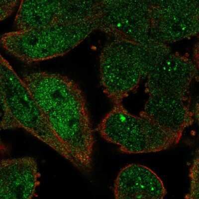 Immunocytochemistry/ Immunofluorescence: ZWINT Antibody [NBP1-82868]
