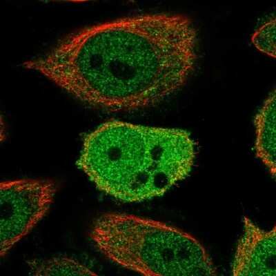 Immunocytochemistry/ Immunofluorescence: ZWINT Antibody [NBP1-82869]