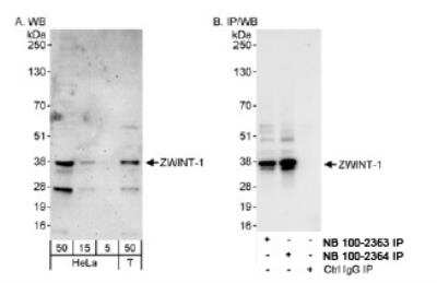 Western Blot: ZWINT Antibody [NB100-2364]