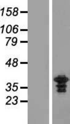 Western Blot: ZWINT Overexpression Lysate [NBL1-18277]