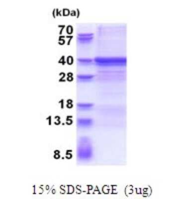 SDS-PAGE: Recombinant Human ZWINT His Protein [NBP2-51659]