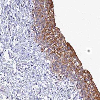 Immunohistochemistry-Paraffin: ZXDB Antibody [NBP2-54712]