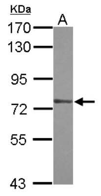 Western Blot: ZXDA Antibody [NBP2-21059]