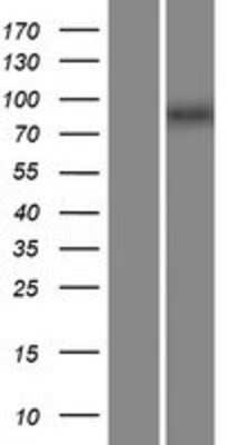 Western Blot: ZXDA Overexpression Lysate [NBP2-07524]