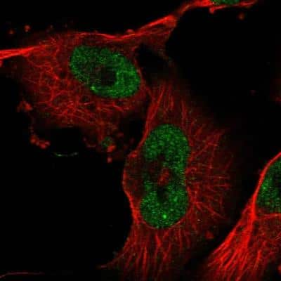 Immunocytochemistry/ Immunofluorescence: ZXDB Antibody [NBP2-54712]