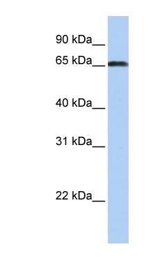 Western Blot: ZXDC Antibody [NBP1-79368]