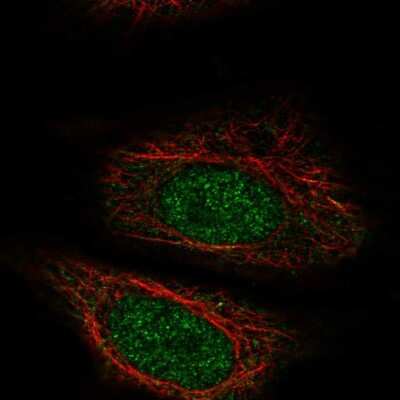 Immunocytochemistry/ Immunofluorescence: ZYG11A Antibody [NBP2-57550]