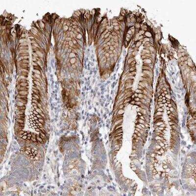 Immunohistochemistry-Paraffin: ZYG11A Antibody [NBP1-93432]