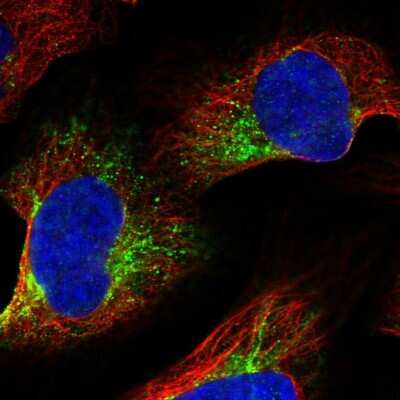 Immunocytochemistry/ Immunofluorescence: ZYG11B Antibody [NBP1-82255]