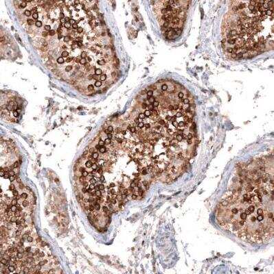 Immunohistochemistry-Paraffin: ZYG11B Antibody [NBP1-82255]