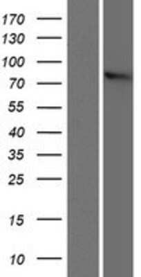 Western Blot: ZYG11B Overexpression Lysate [NBP2-06305]