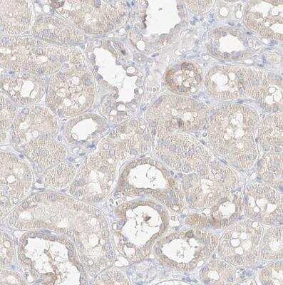 Immunohistochemistry-Paraffin: ZZEF1 Antibody [NBP1-83827]