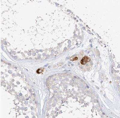 Immunohistochemistry-Paraffin: ZZEF1 Antibody [NBP1-83827]