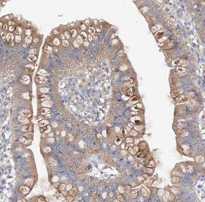 Immunohistochemistry-Paraffin: ZZEF1 Antibody [NBP1-83827]