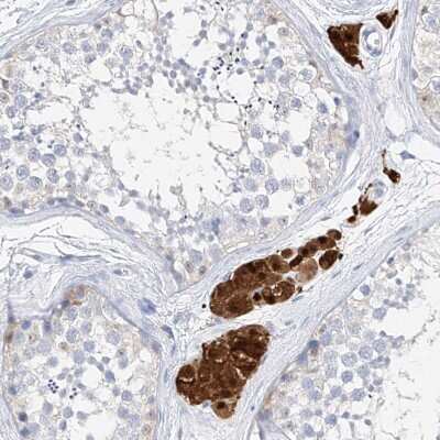 Immunohistochemistry-Paraffin: ZZEF1 Antibody [NBP1-83828]