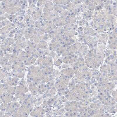Immunohistochemistry-Paraffin: ZZEF1 Antibody [NBP1-83828]
