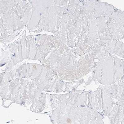 Immunohistochemistry-Paraffin: ZZEF1 Antibody [NBP1-83828]