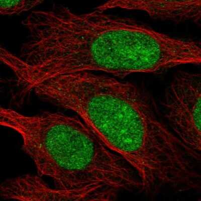 Immunocytochemistry/ Immunofluorescence: ZZZ3 Antibody [NBP2-58530]