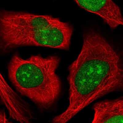 Immunocytochemistry/ Immunofluorescence: ZZZ3 Antibody [NBP2-58650]