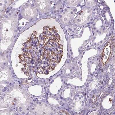 Immunohistochemistry: ZZZ3 Antibody [NBP2-49475]