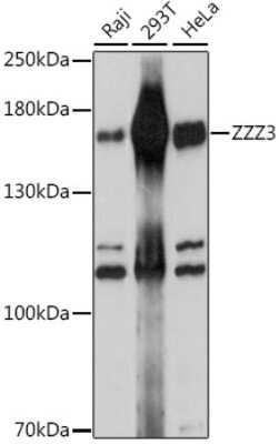 Western Blot: ZZZ3 AntibodyAzide and BSA Free [NBP2-94164]