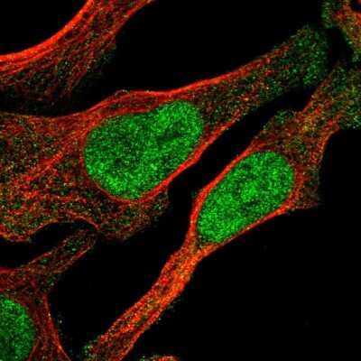 Immunocytochemistry/ Immunofluorescence: Zeta Opioid Receptor Antibody [NBP1-90340]