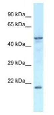 Western Blot: Zfp113 Antibody [NBP1-91373]