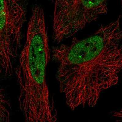 Immunocytochemistry/ Immunofluorescence: Zfp219 Antibody [NBP2-31626]