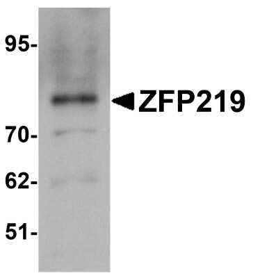 Western Blot: Zfp219 AntibodyBSA Free [NBP1-76550]