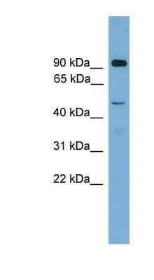 Western Blot: Zfy2 Antibody [NBP1-91542]