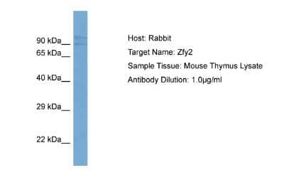 Western Blot: Zfy2 Antibody [NBP2-84345]