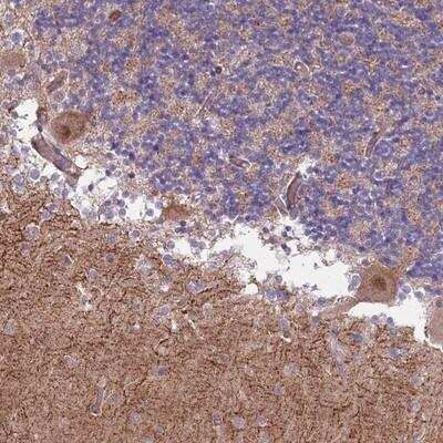 Immunohistochemistry-Paraffin: Zhangfei Antibody [NBP2-13874]